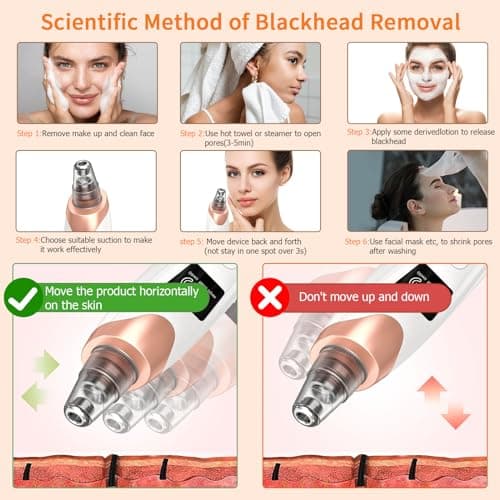 2026 Pore Vacuum, USB Rechargeable Blackhead Remover Vacuum,3 Levels Adjustable Pore Vacuum Blackhead Remover, with 5 Suction Power,6 Probes,Face Vacuum Pore Cleanser for Women & Men-White