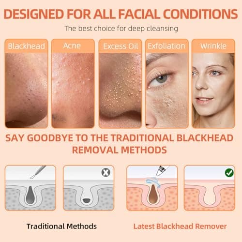 2026 Pore Vacuum, USB Rechargeable Blackhead Remover Vacuum,3 Levels Adjustable Pore Vacuum Blackhead Remover, with 6 Suction Power Probe,4 Golden Needle face Vacuum Pore Cleanser Kit-White