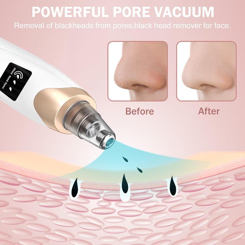 Blackhead Remover Pore Vacuum Kit -Blackhead Extractor Tool with 3 Adjustable Suction Levels, 5 Probes, USB Rechargeable, Suitable for Women and Men(White)