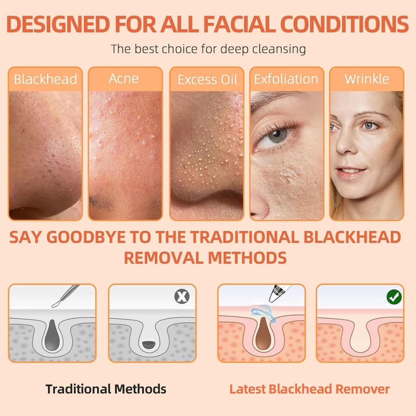 2026 Pore Vacuum, USB Rechargeable Blackhead Remover Vacuum,3 Levels Adjustable Pore Vacuum Blackhead Remover, with 6 Suction Power Probe,4 Golden Needle face Vacuum Pore Cleanser Kit-White