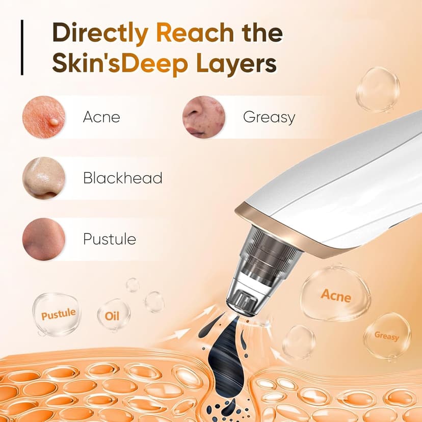 Blackhead Remover Vacuum - Professional Blackhead Extractor for Face with 3 Adjustable Suction Levels, USB Rechargeable Pore Cleaner, and 5 Interchangeable Probes (White)