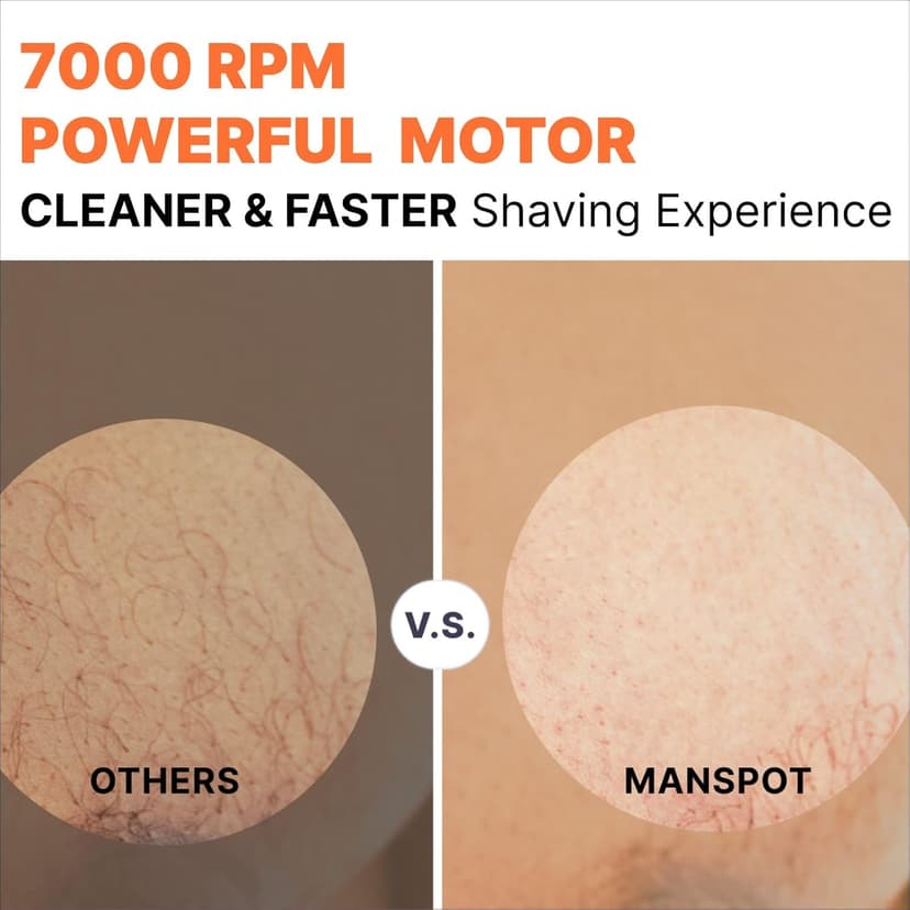 MANSPOT Manscape Groin & Body Hair Trimmer for Men, Electric Ball Pubic Trimmer Shaver,Manscape Kit with 4 Guard,Replaceable Ceramic Blade Heads,Waterproof Wet/Dry Shaver,90 Minutes Shaving