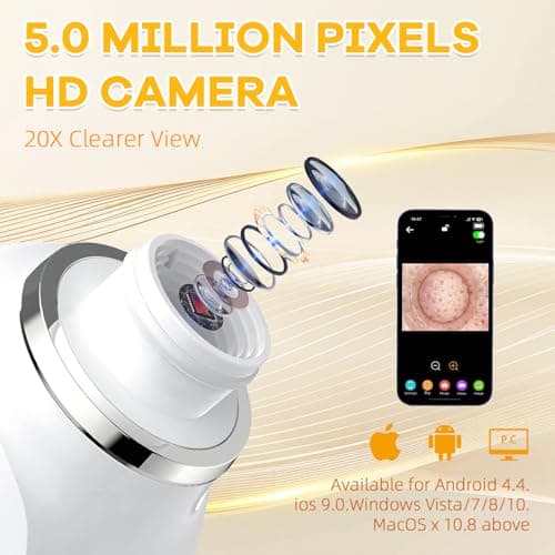 2026 Pore Vacuum with Camerafor, USB Rechargeable Blackhead Remover Vacuum,3 Levels Adjustable Pore Vacuum Blackhead Remover, 6 Suction Heads,Face Vacuum Pore Cleanser for Women & Men-White