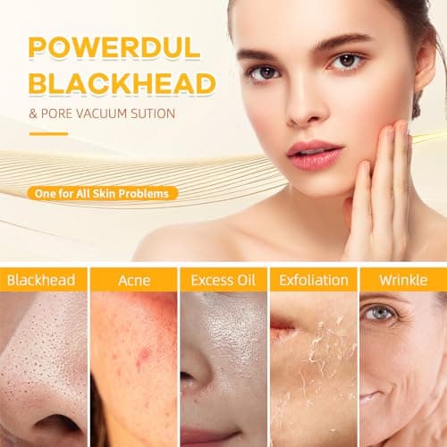 2026 Pore Vacuum with Camerafor, USB Rechargeable Blackhead Remover Vacuum,3 Levels Adjustable Pore Vacuum Blackhead Remover, 6 Suction Heads,Face Vacuum Pore Cleanser for Women & Men-White