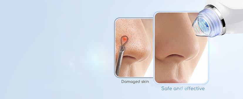 Blackhead Remover Vacuum, USB Interface Type Pore Vacuum, Black Head Extractions Tool with Camera for Men and Women Pore Cleaner, 3 Adjustment Modes & 6 Suction Heads(Light Pink)