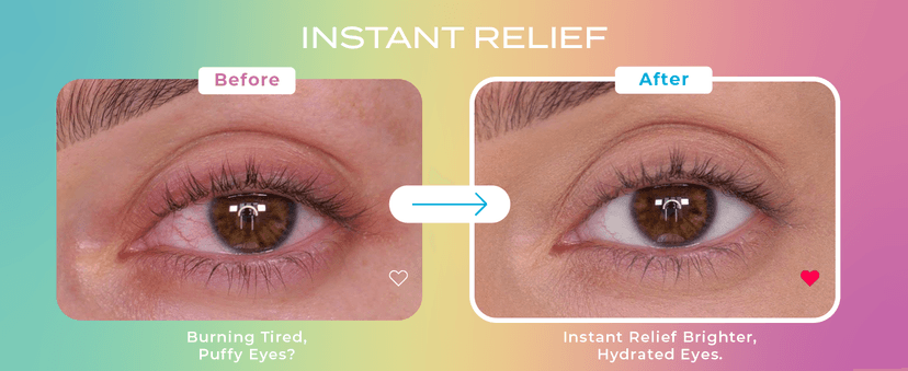 Body Restore Heated Eye Mask for Dry Eyes 5 Pack - Self Heating Warm Compress, Christmas Stocking Stuffers, White Elephant, Birthday Gifts for Women, Men, Stye Eye Treatment, Relaxation - Variety