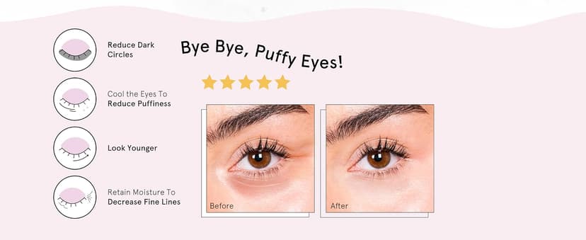 grace & stella Under Eye Patches (12 pairs) Eye Masks for Puffy Eyes and Dark Circles - Birthday Gifts for Women, Bachelorette Party Favors, Bridesmaid, Self Care and Relaxation Gifts for Her - Vegan