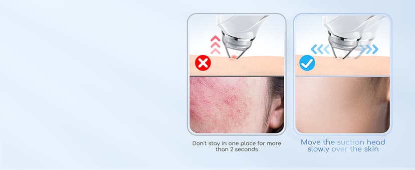 Blackhead Remover Vacuum, USB Interface Type Pore Vacuum, Black Head Extractions Tool with Camera for Men and Women Pore Cleaner, 3 Adjustment Modes & 6 Suction Heads(Light Pink)