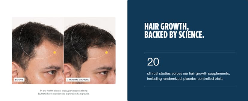 Nutrafol Men's Hair Growth Supplements, Clinically Tested for Visibly Thicker Hair and Scalp Coverage, Dermatologist Recommended - 1 Month Supply